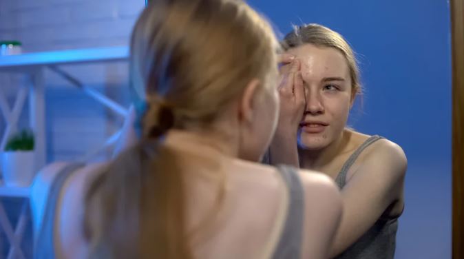 Tschüss Pickel! Wie Teenager hormonelle Hautprobleme natürlich in den Griff bekommen - wie Caps beauty&hair von innen helfen