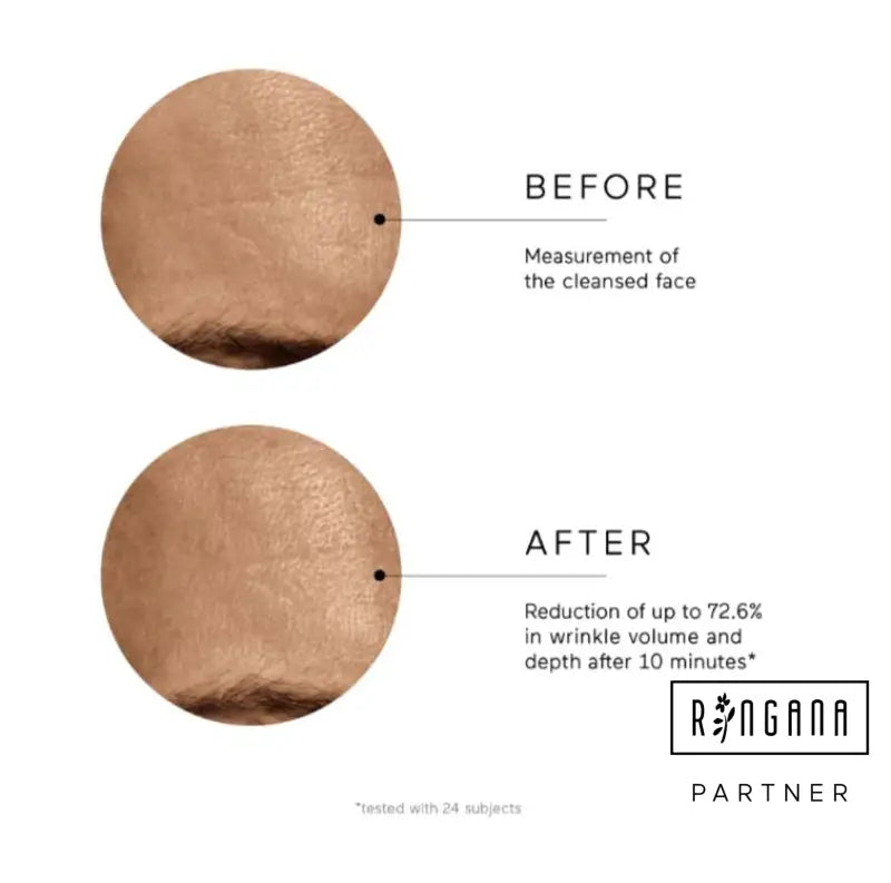 RINGANA ADDS effect EXPRESS-LIFTING FÜR EINEN VERJÜNGTEN LOOK