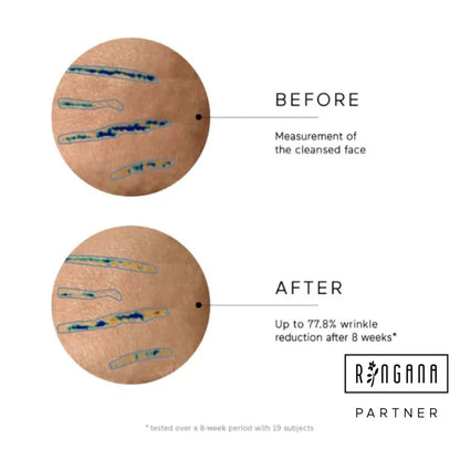 Ringana FRESH anti wrinkle serum ANTI-FALTEN-SERUM