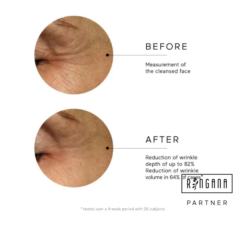 RINGANA FRESH eye serum